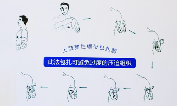 彈力繃帶包扎使用方法及注意事項